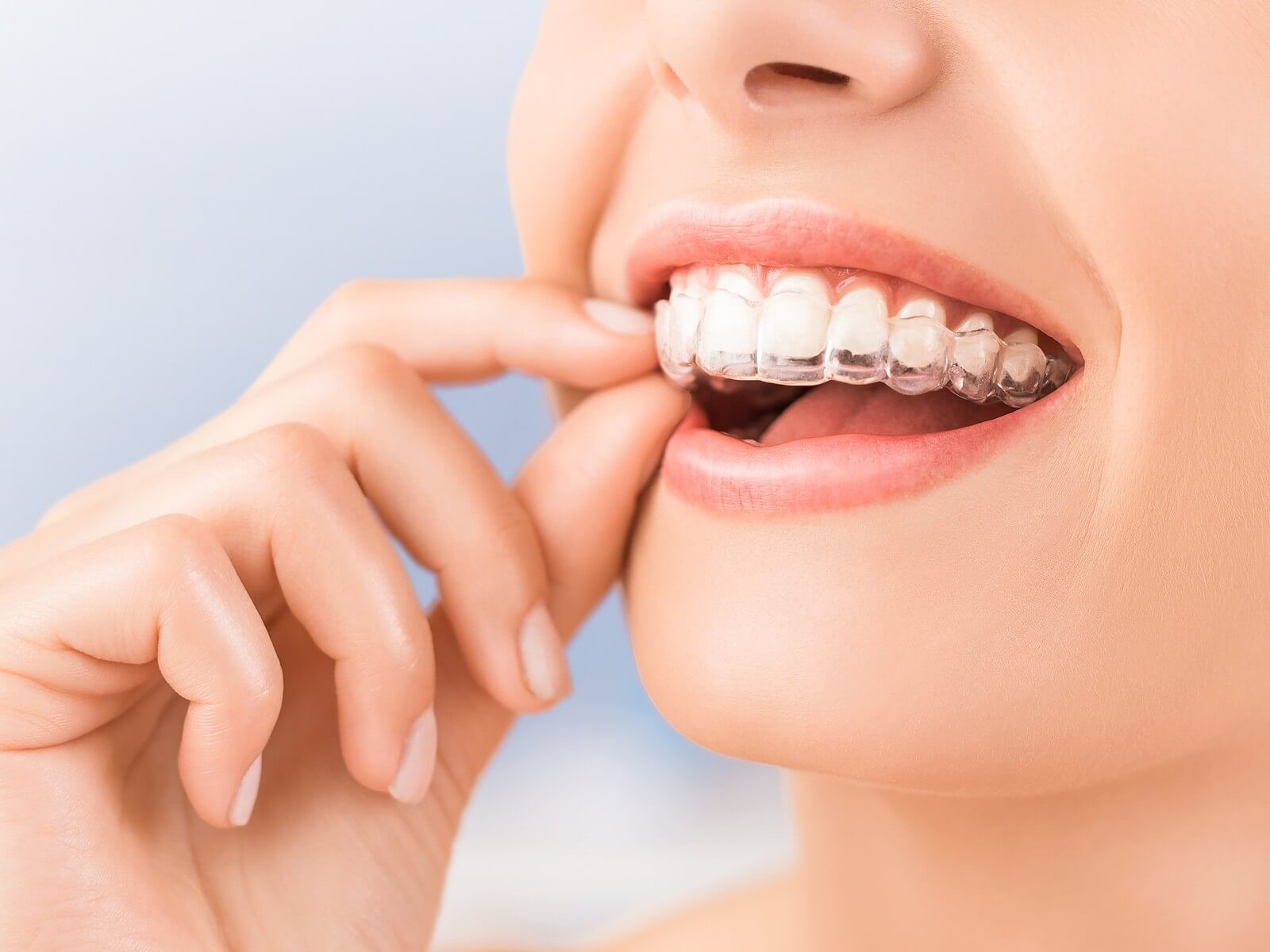 How long do I need to wear a retainer after Invisalign?