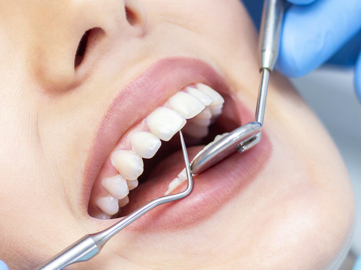 How often should you get a dental cleaning?