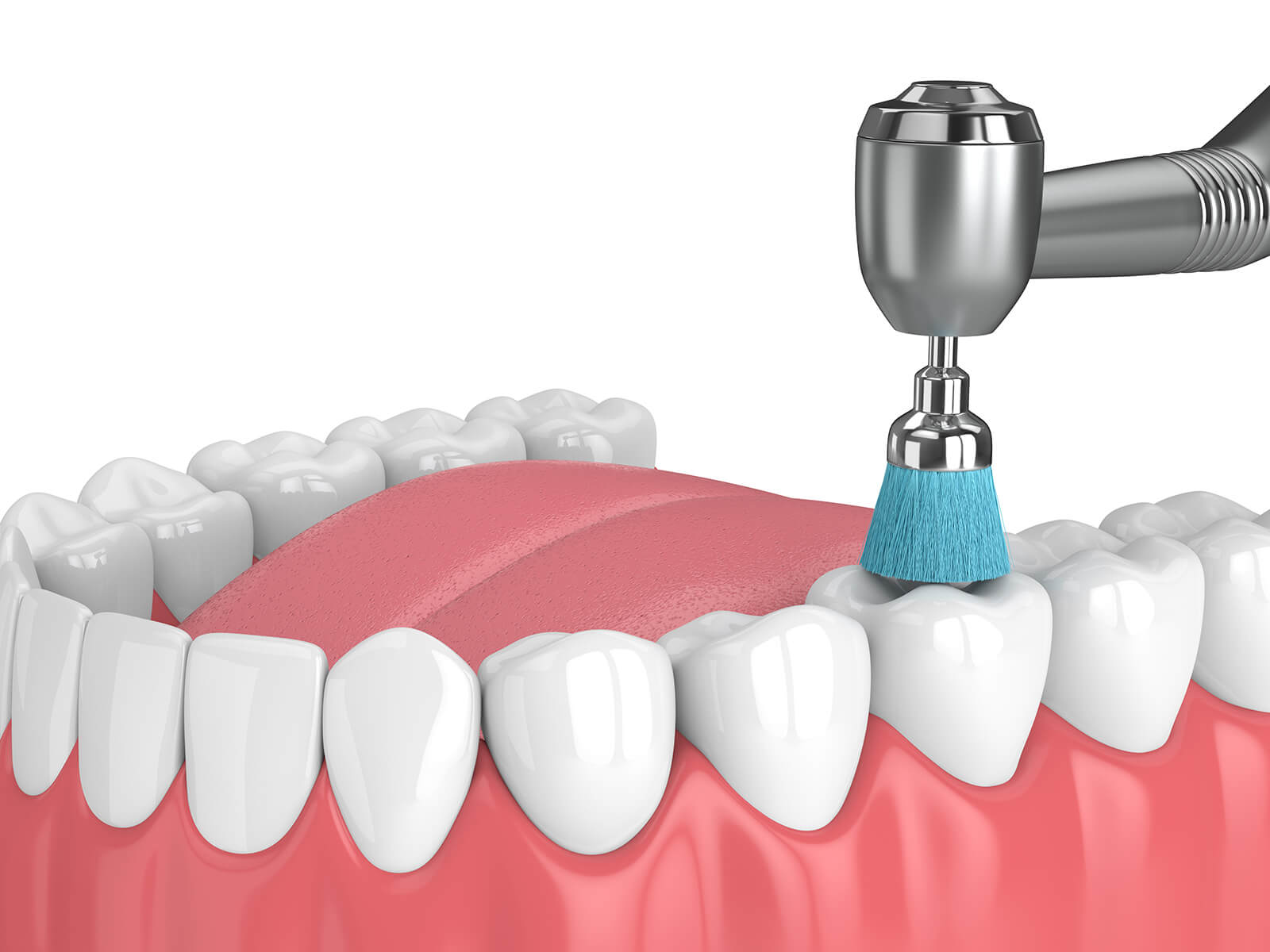 Everything You Need To Know About Tooth Polishing