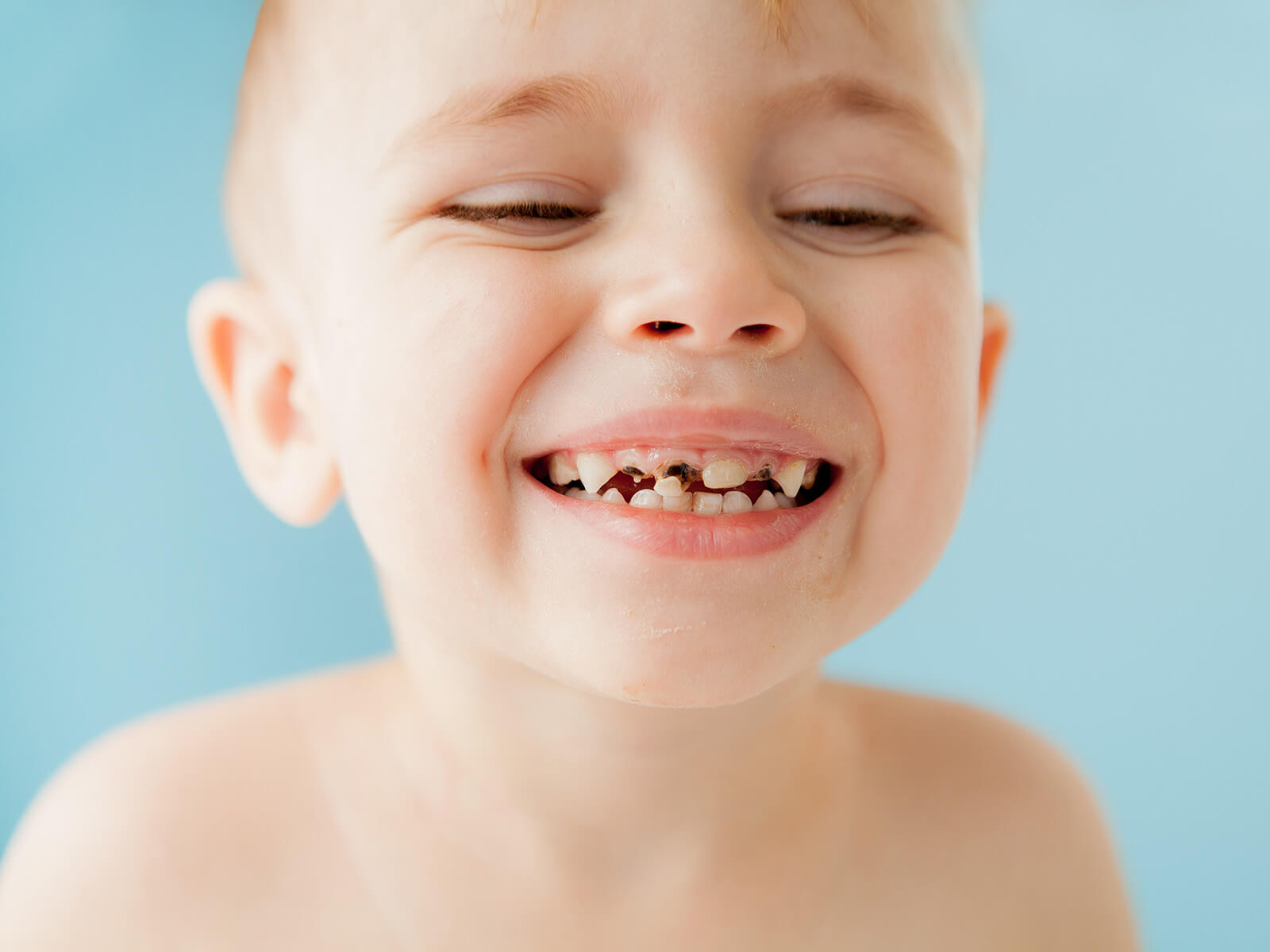 What To Do If Your Child Chips, Cracks, Or Knocks Out A Tooth