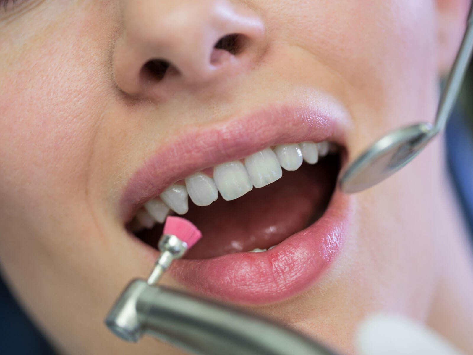 How Long Does a Professional Teeth Cleaning Take?