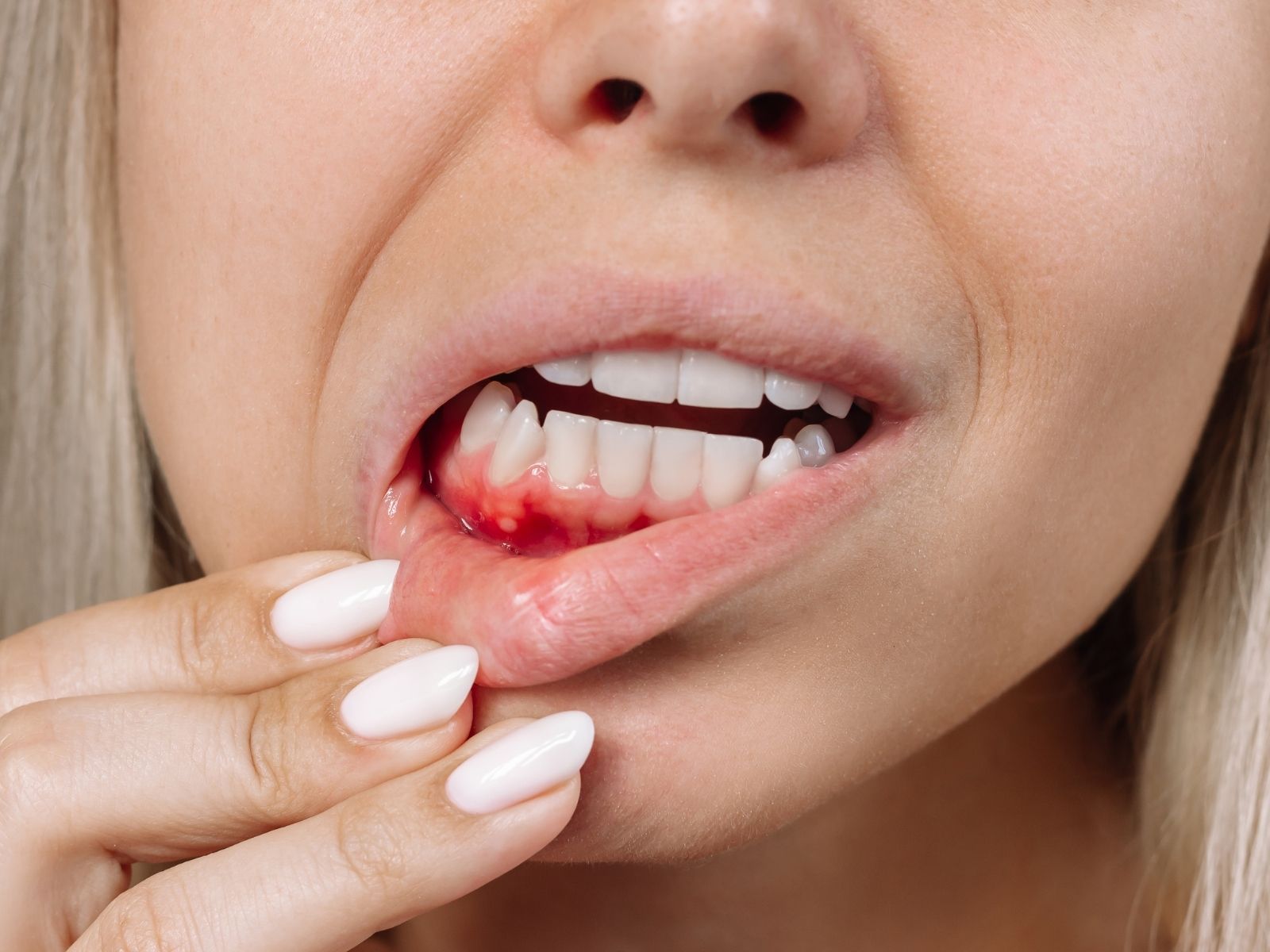 How to Stop Bleeding Gums: From Home Remedies to Dental Treatment